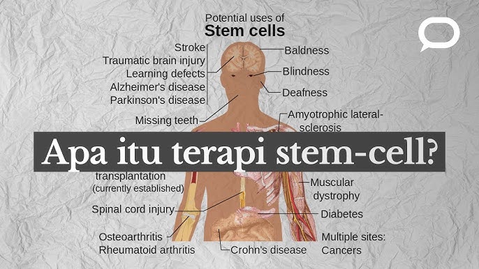 Penyembuhan Darah Tinggi dengan Stem Cell: Potensi dan Manfaatnya